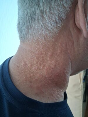 Dave Neck